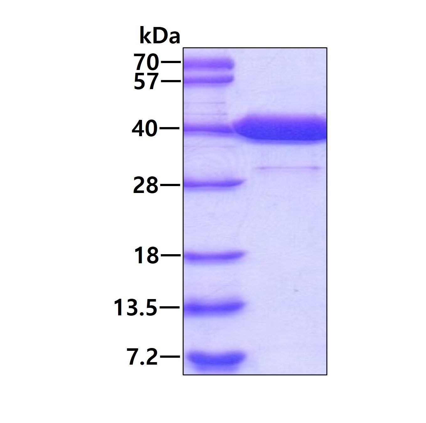 3ug by SDS-PAGE under reducing condition and visualized by coomassie blue stain.
