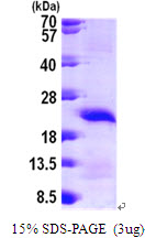 3ug by SDS-PAGE under reducing condition and visualized by coomassie blue stain.