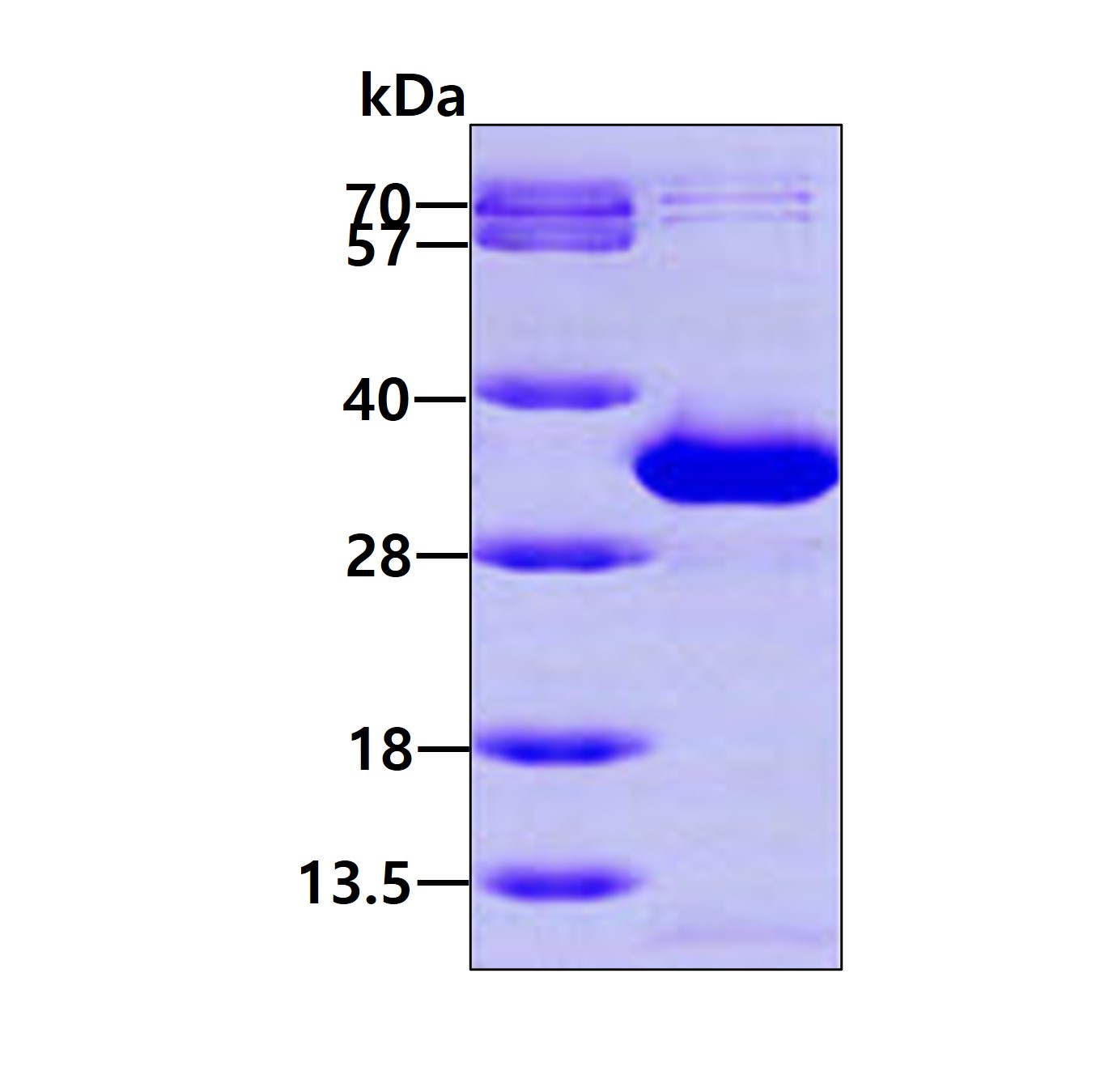 3ug by SDS-PAGE under reducing condition and visualized by coomassie blue stain.