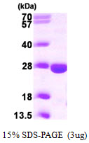 3ug by SDS-PAGE under reducing condition and visualized by coomassie blue stain.