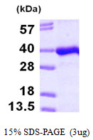 3ug by SDS-PAGE under reducing condition and visualized by coomassie blue stain.