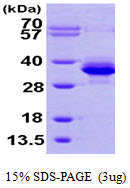 3ug by SDS-PAGE under reducing condition and visualized by coomassie blue stain.