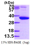3ug by SDS-PAGE under reducing condition and visualized by coomassie blue stain.