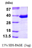 3ug by SDS-PAGE under reducing condition and visualized by coomassie blue stain.