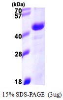 3ug by SDS-PAGE under reducing condition and visualized by coomassie blue stain.