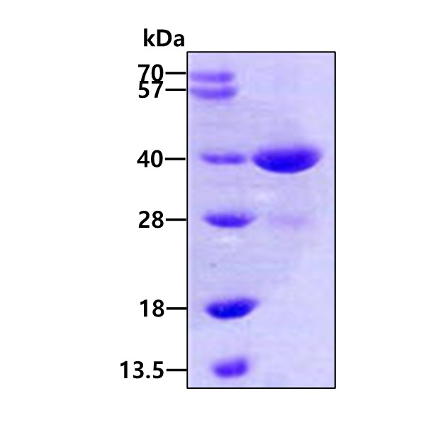 3ug by SDS-PAGE under reducing condition and visualized by coomassie blue stain.