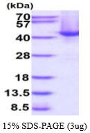 3ug by SDS-PAGE under reducing condition and visualized by coomassie blue stain.