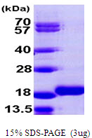 3ug by SDS-PAGE under reducing condition and visualized by coomassie blue stain.