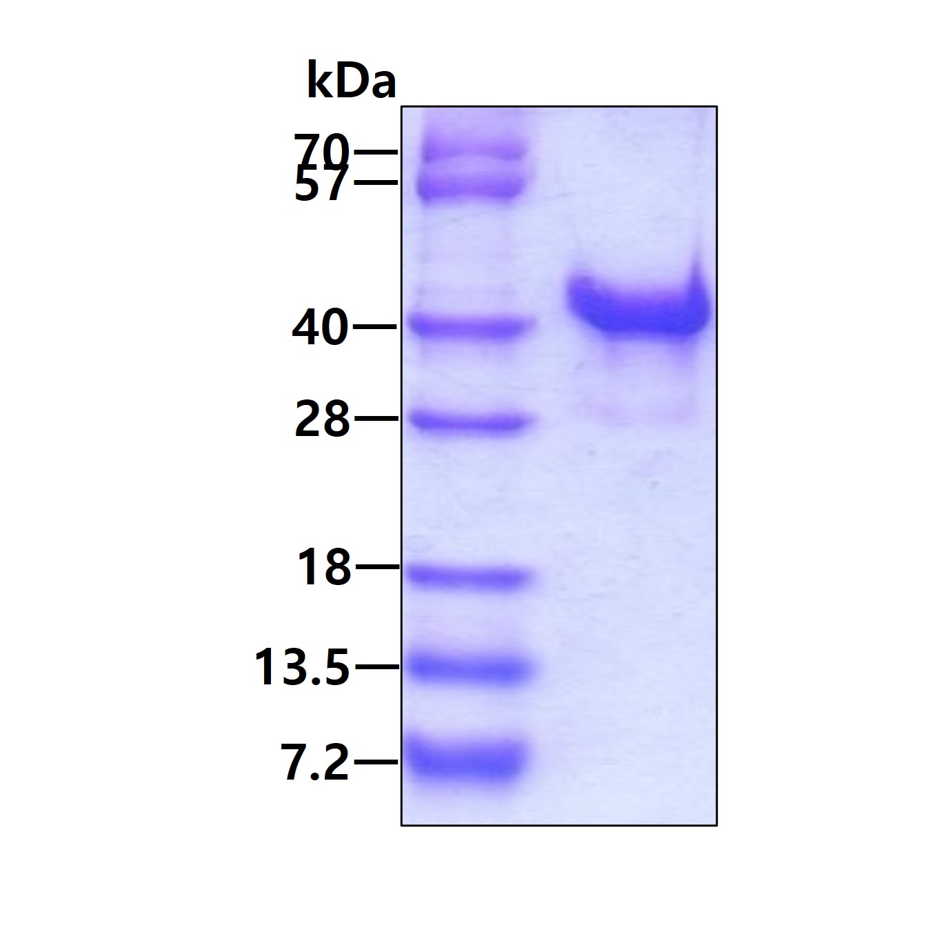 3ug by SDS-PAGE under reducing condition and visualized by coomassie blue stain.