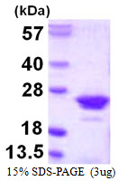 3ug by SDS-PAGE under reducing condition and visualized by coomassie blue stain.