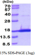 3ug by SDS-PAGE under reducing condition and visualized by coomassie blue stain.