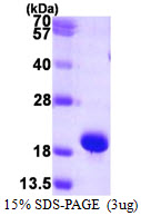 3ug by SDS-PAGE under reducing condition and visualized by coomassie blue stain.