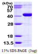 3ug by SDS-PAGE under reducing condition and visualized by coomassie blue stain.