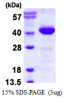 3ug by SDS-PAGE under reducing condition and visualized by coomassie blue stain.