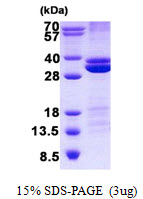 3ug by SDS-PAGE under reducing condition and visualized by coomassie blue stain.