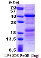 3ug by SDS-PAGE under reducing condition and visualized by coomassie blue stain.