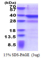 3ug by SDS-PAGE under reducing condition and visualized by coomassie blue stain.
