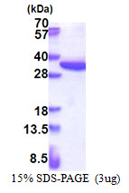 3ug by SDS-PAGE under reducing condition and visualized by coomassie blue stain.