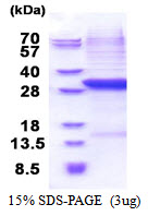 3ug by SDS-PAGE under reducing condition and visualized by coomassie blue stain.