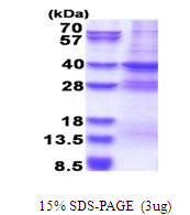 3ug by SDS-PAGE under reducing condition and visualized by coomassie blue stain.