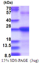 3ug by SDS-PAGE under reducing condition and visualized by coomassie blue stain.