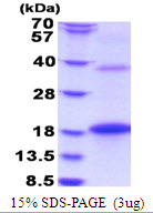 3ug by SDS-PAGE under reducing condition and visualized by coomassie blue stain.