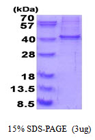 3ug by SDS-PAGE under reducing condition and visualized by coomassie blue stain.