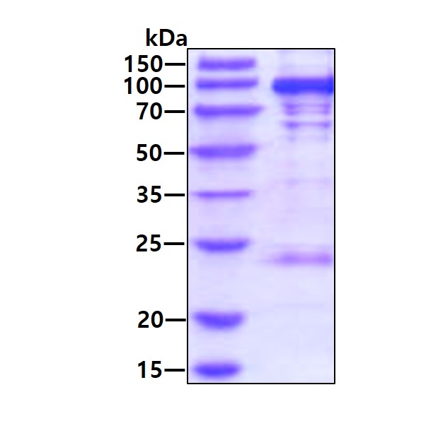 3ug by SDS-PAGE under reducing condition and visualized by coomassie blue stain