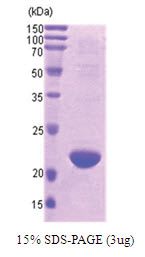 DIABLO / SMAC (56-239) Human Protein