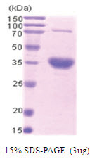 BIRC7 / LIVIN (1-298) Human Protein