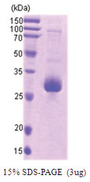 IAP4 / BIRC5 (full length) Human Protein