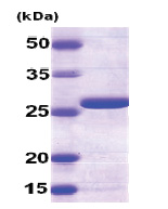 Adenylate kinase 2 / AK2 (1-239, His-tag) Human Protein