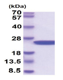 AGR2 (21-175, His-tag) Human Protein