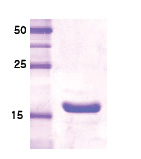 Somatotropin / Growth Hormone / GH1 (20 kDa Variant) Human Protein