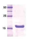Somatotropin / Growth Hormone / GH1 (20 kDa Variant) Human Protein