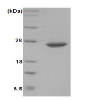 Disulfide-bond isomerase (21-236) Escherichia coli Protein