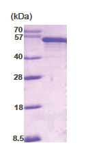 PDCD4 (1-469) Human Protein