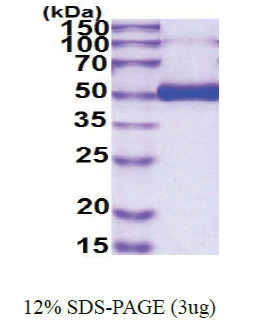 Osteoprotegerin / TNFRSF11B (22-401, His-tag) Human Protein Osteoprotegerin / TNFRSF11B (22-401, His-tag) Human Protein