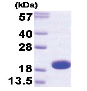 Skeletal muscle Troponin C (1-160) Human Protein Skeletal muscle Troponin C (1-160) Human Protein