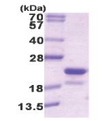 Riboflavin kinase (RFK) (1-162, His-tag) Human Protein Riboflavin kinase (RFK) (1-162, His-tag) Human Protein