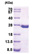 DHFR / DHFRP1 (1-187, His-tag) Human Protein