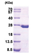 DHFR / DHFRP1 (1-187, His-tag) Human Protein