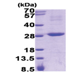 RGS16 / RGSR (1-202, His-tag) Human Protein RGS16 / RGSR (1-202, His-tag) Human Protein