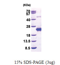 DCTD (1-178, His-tag) Human Protein