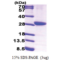 HPGD (1-266, His-tag) Human Protein
