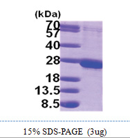 RAB1B (1-201, His-tag) Human Protein