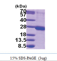 RAB1B (1-201, His-tag) Human Protein