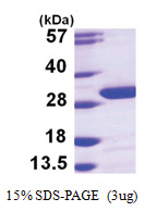 UCHL3 (1-230, His-tag) Human Protein