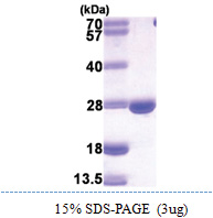 DHFR / DHFRP1 (1-187, His-tag) Mouse Protein