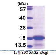 MYL6 (1-151, His-tag) Human Protein MYL6 (1-151, His-tag) Human Protein